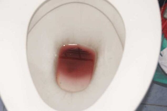 စိတ်လှုပ်ရှားနေချိန်မှာ အမျိုးသားတွေမှာ တွေ့ရတတ်ပါတယ်။